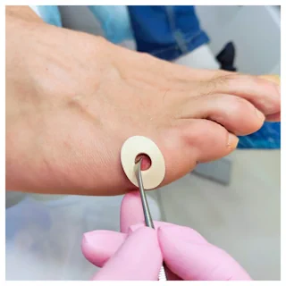 Derma Ped gallery image
